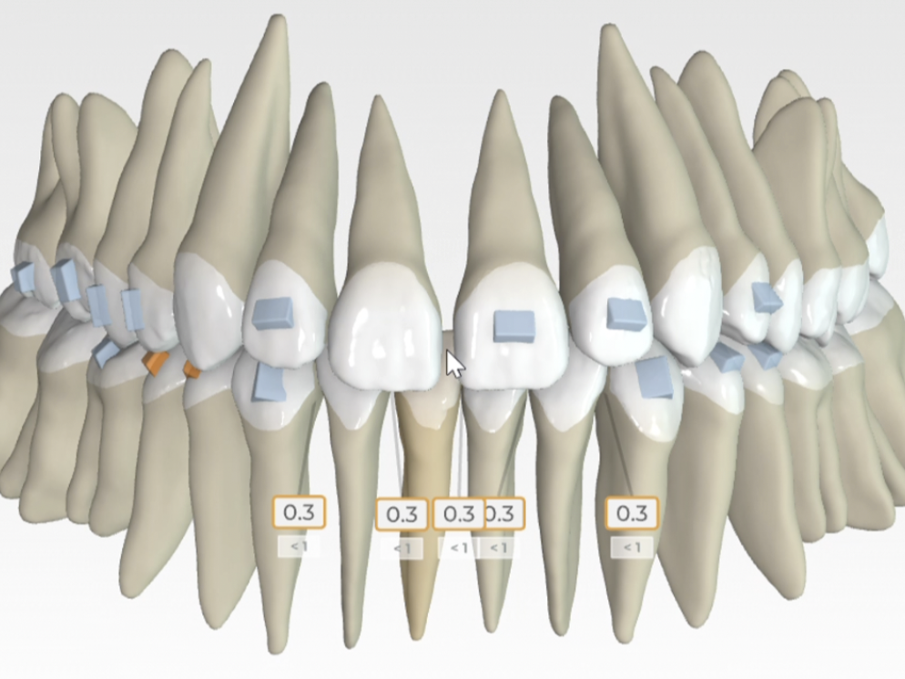 Amprentă Digitală 3D